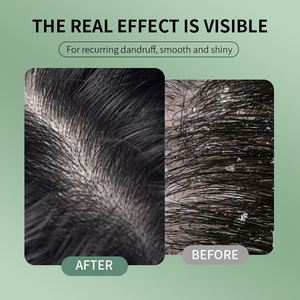 Champú Hidratante en Espuma de 780 ml, Champú Profesional Orgánico a Base de Hierbas Anticaspa con Fórmula 2 en 1, Limpieza Profunda y Unisex - Product Image 4