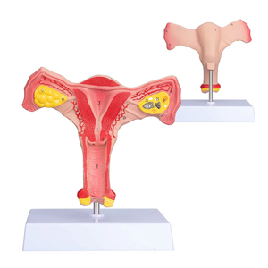 แบบจำลองมดลูกและรังไข่ทั้งสองด้าน แบบจำลองมดลูกหญิง สำหรับสื่อการสอน การเรียนรู้วิทยาศาสตร์การแพทย์ กายวิภาคศาสตร์ แบบจำลองมดลูก - Product Image 2