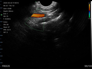 Transvaginal <span class=keywords><strong>Probe</strong></span> Ultrasound nirkabel tunggal, untuk GY OB - Product Image 4
