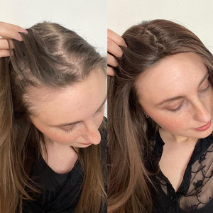 Siero per Capelli al Rosmarino Naturale Pronto per la Spedizione, Olio Essenziale Roll-on con Redensyl per Massaggio del Cuoio Capelluto, Ricrescita e Cura dei Capelli - Product Image 3