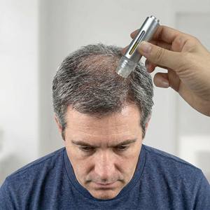 Kit de Microinfusión para el Crecimiento del Cabello, Masajeador de Cabeza con Sello <span class=keywords><strong>Derma</strong></span> Renewal Dorado - Product Image 5