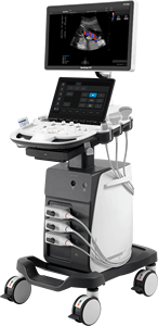 Ecógrafo Doppler Color Sonoscape P9 Elite con Función de IA para Clínica Veterinaria y Hospital - Product Image 3