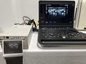 Nouvel appareil d'<span class=keywords><strong>échographie</strong></span> médicale, échographe couleur, appareil d'<span class=keywords><strong>échographie</strong></span> hospitalier, obstétrique et gynécologie, femmes enceintes - Product Image 1