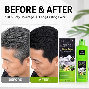 แชมพูย้อมผม QKDS บริการพิเศษ <span class=keywords><strong>แนะนำ</strong></span>เป็นอย่างยิ่ง ฟองเร็ว บำรุงล้ำลึก ปลอบประโลมหนังศีรษะ - Product Image 3