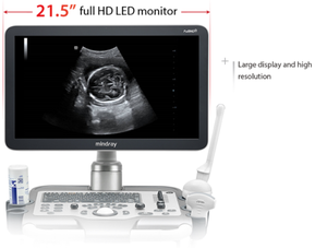 마인드레이 심장 초음파, 마인드레이 4D 컬러 도플러 초음파, 마인드레이 DC 30 초음파 - Product Image 6