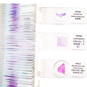 100 Pezzi di Vetrini per Microscopia Patologica Umana per l'Insegnamento - Product Image 2