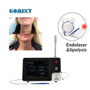 Laser Endolif Portabel 30w 980 1470nm Botol Lemon Penghancur Lemak Endolaser Pengencang Wajah Terapi Fisik Laser Jamur Kuku Tubuh - Product Image 1