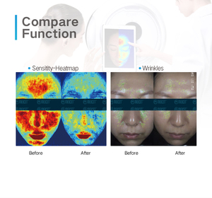 Analizador de Piel UV con IA MC10, Compatible con Enchufes EU/IT, Análisis de 5 Espectros en Área Facial, Uso Comercial Premium - Product Image 3