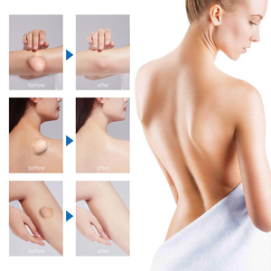 Gel corporel nourrissant aux herbes 10ml avec une durée de conservation de 2 ans pour soulager les nodules et les bosses sur les jambes et le dos - Product Image 5