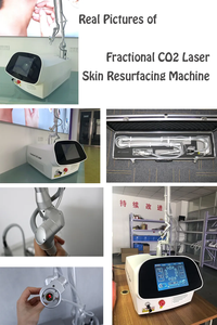 Machine fractionnelle professionnelle pour le visage, machine fractionnelle pour le resserrement vaginal, pour usage dermatologique, <span class=keywords><strong>laser</strong></span> fractionnel CO2 - Product Image 3