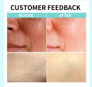 Crema y Loción Facial para el Cuidado de la Piel Negra Africana de Marca Privada, Blanqueadora e Iluminadora, Elimina las Manchas Oscuras, Crema Aclarante, Set para el Cuidado de la Piel - Product Image 6