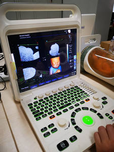 Mesin Ultrasound Doppler Warna 3D 4D Portabel untuk Ekokardiografi Medis - Product Image 3