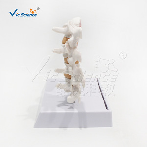 Modèle d'ostéoporose VIC-V45 (2 parties), modèle de maladie, modèle d'anatomie squelettique de la colonne vertébrale humaine - Product Image 3