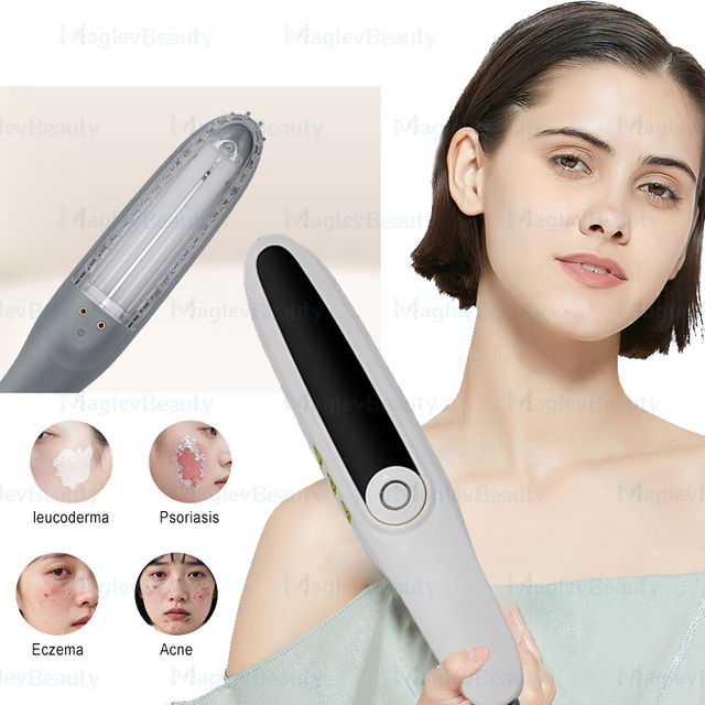 Mini 308nm UVB Phototherapy Excimer Laser Vitiligo Psoriasis Uv Lamp Phototherapy Light Therapy Vitiligo Cream Treatment Clinic