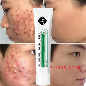 Gel Perbaikan Bekas Jerawat Cepat dan Efektif, Penghilang Noda, Menghaluskan Kulit, Mengecilkan Pori-pori, Krim Jerawat - Product Image 4