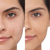 Aangepaste Perzik Zwarte Kop Verwijderaar Whitening Anti-Acne Gezicht Fruit Porie Zuiverende Perzik Gezicht Modder Masker