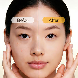 Adesivo Personalizado para Acne Hidrocolóide e Ácido Salicílico - Tratamento Localizado para Espinhas com Cicatrização Rápida - Product Image 2