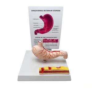 แบบจำลองกายวิภาคกระเพาะอาหารมนุษย์พร้อมโรคภูมิภาคนิยมพบกัน ตัดตามยาว สำหรับ<span class=keywords><strong>การ</strong></span>สอนทาง<span class=keywords><strong>การ</strong></span>แพทย์ - Product Image 3