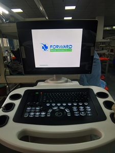 Échographe <span class=keywords><strong>Doppler</strong></span> Couleur Portable Mindray DC-80A 4D 5D – Instruments d'Échographie Médicale pour Hôpitaux - Product Image 4