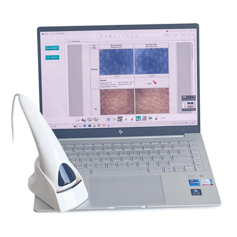 Digitales Gesicht Skincarisma Scope 3 Schicht 3D Visum Haut analyze Derma skin Logica Maschine mit Computer verbinden