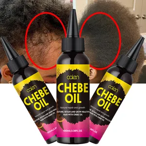 Oalen – huile pour cheveux 100% naturels, traitement contre la perte de cheveux, promotion de la croissance des cheveux