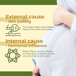 Huile de lissage à l'olive et à la peau nourrissant en profondeur les rides réduisant progressivement les surfaces réparatrices de la peau vente en gros - Product Image 5