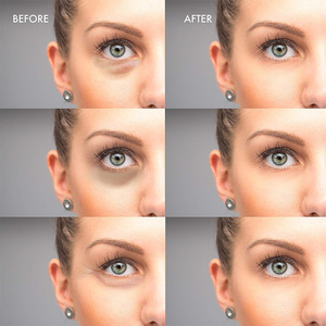 Mascarilla de Ojos de Colágeno Herbal Personalizada con Té Verde y Ácido Hialurónico, Anti-Ojeras, Hidratante, Parche de Hidrogel para Arrugas - Product Image 2