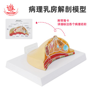 Modelo de patología mamaria humana, modelo de anatomía patológica, enfermedades mamarias comunes, modelo de patología mamaria humana - Product Image 5