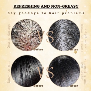 Champú Anticaspa para el Cuidado del Cuero Cabelludo <span class=keywords><strong>de</strong></span> Marca Privada, Exfoliante y Desintoxicante con <span class=keywords><strong>Sal</strong></span> Marina para Cuero Cabelludo Seco - Product Image 6