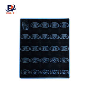 Film radiographique <span class=keywords><strong>dentaire</strong></span> <span class=keywords><strong>panoramique</strong></span> Offre Spéciale - Product Image 4