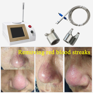 Máquina Láser de Diodo de 980nm y 30W para Eliminación de Hongos en las Uñas, Arañas Vasculares y Tratamiento Vascular, Dispositivo de Belleza para Uso en Clínicas, Salones y Spas - Product Image 4