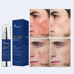 Hidratante facial 6 en 1 para <span class=keywords><strong>hombre</strong></span>, Retinol orgánico Natural, crema antiarrugas antienvejecimiento, humectante blanqueador para el cuidado <span class=keywords><strong>de</strong></span> la piel <span class=keywords><strong>de</strong></span> la cara y los <span class=keywords><strong>ojos</strong></span> - Product Image 5