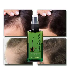 OEM ODM Private Label all'ingrosso di crescita dei capelli spruzzatura 120ml olio per la crescita dei capelli per gli uomini donne trattamento dei capelli