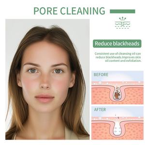 Aceite Limpiador de Poros Heartleaf de 100ml al por Mayor para el Cuidado Facial, Reducción de Puntos Negros, Aceite Desmaquillante Calmante - Product Image 5