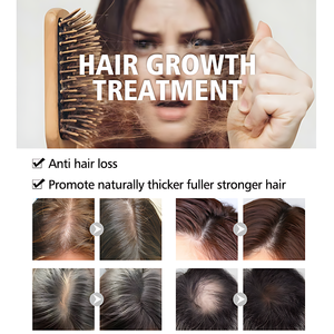 Champú de Aloe Vera Orgánico de Marca Blanca, Fortalece, Densifica, Nutre, Aumenta <span class=keywords><strong>el</strong></span> Volumen, Suaviza, Combate la Caspa y la Caída del Cabello - Product Image 2