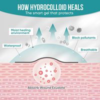 Pansement hydrocolloïde de qualité médicale en rouleau pour le soin des plaies, auto-adhésif, découpable sur mesure, imperméable, pour ampoules, acné, brûlures