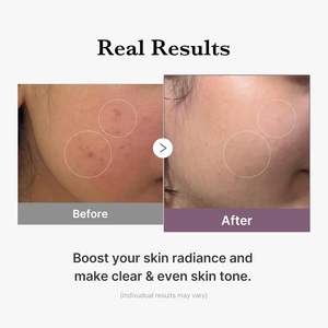 Tonique éclaircissant Medicube Age-R Glutathione 140ml pour peaux sensibles avec complexe de peptides - Product Image 5