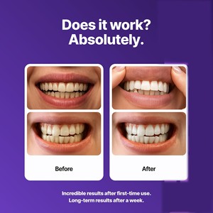 Bandes blanchissantes multifonctionnelles pour les dents, éliminent les taches de fumée, les dents jaunes, rafraîchissent l'haleine, patchs buccaux, nasaux et corporels contre les boutons - Product Image 4