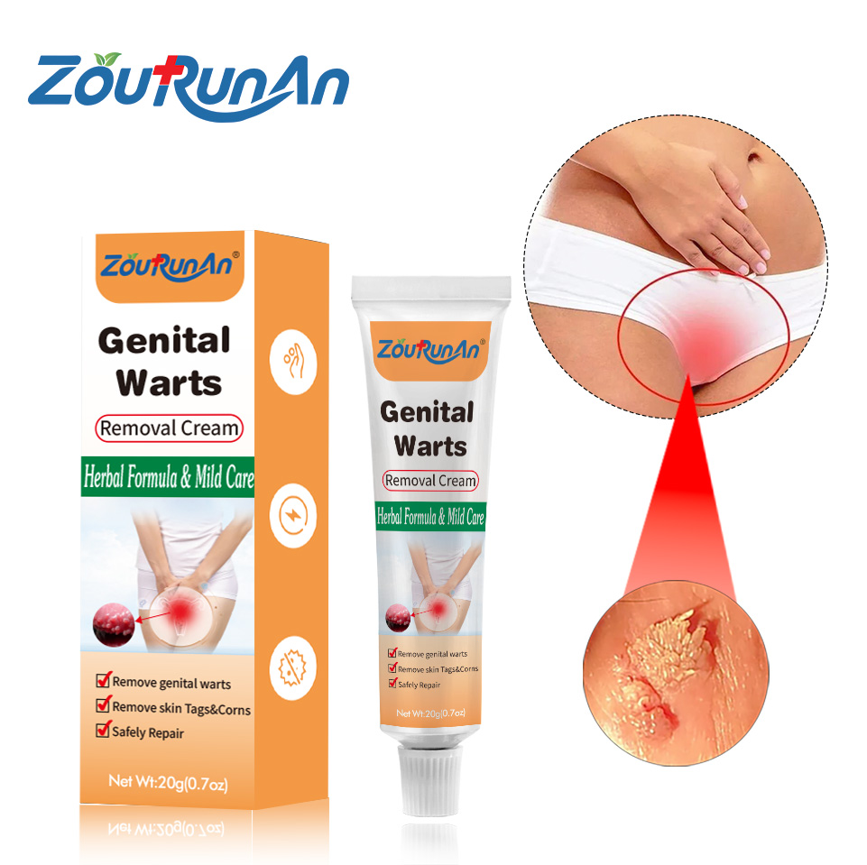 ZouRunAn Genital Wart Ointment Papillomas Removal of Warts Ointment From Skin Tags Removing Against Moles Remover Cream