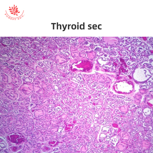 Eierstöcke Medizinische Wissenschaft Hochschul bildung Eierstock Abschnitt <span class=keywords><strong>Human</strong></span> histologie Folien - Product Image 3