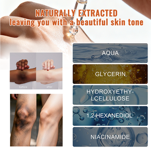Novo Sérum Removedor de Manchas Escuras 2025 para Mãos, Pés e Joelhos, Sérum Clareador com Niacinamida, Remove Pigmentação de Tornozelos Negros - Product Image 2