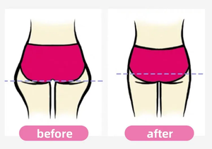 HWH-0008 # sacroiliac hip vành đai thấp trở lại hỗ trợ hip niềng răng cho hip đau hỗ trợ vành đai đau thần kinh tọa một cách dễ dàng bảo vệ - Product Image 6