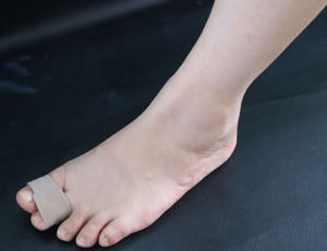 Médico de juanete Hallux Valgus Corrector dedo del pie separador juanete cada noche férula Hallux Valgus - Product Image 5