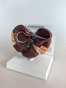 Modelo de Hígado Canino Patológico Colorido - Modelo Anatómico de Hígado de Perro con Lesiones Patológicas para Educación Veterinaria - Product Image 2
