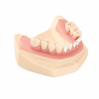 Modèle pédagogique d'implant dentaire de qualité médicale, modèle de pont Malo avec couronne en zircone pour la formation des dentistes
