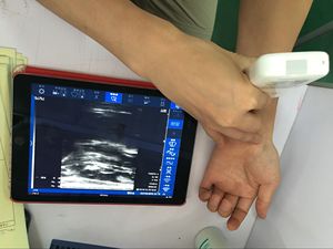 MSLPU42 Hospital Use and the Cheapest Wireless <strong>Linear</strong> <strong>Ultrasound</strong> - Product Image 5
