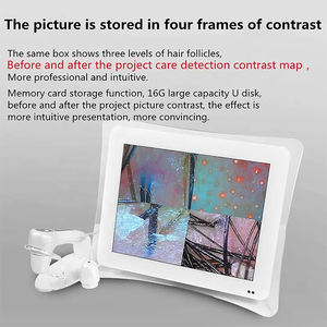Analyseur de cheveux numérique de 11 pouces avec 4 analyses de perspective spectrale Grossissement 50X-200X Soins de la peau à domicile Utilisation du cuir chevelu - Product Image 3