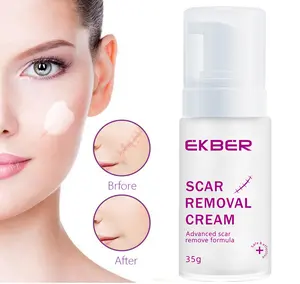 Scar Removing Cream Herbal Effective Skin Repairing Gel Natural Acne Pimple Mark Stretch Marks Repair Scar Removal Cream