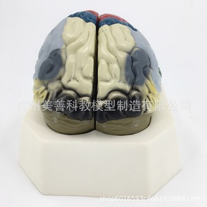 Modèle de lobulation cérébrale, modèle d'artère cérébrale, modèle d'anatomie du cerveau, modèle de région fonctionnelle du cerveau, modèle de cerveau en couleur - Product Image 3