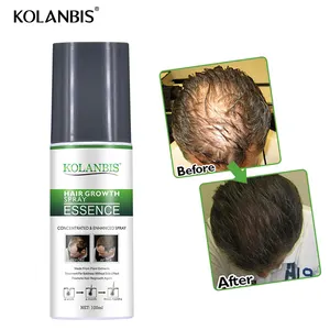 Amazon top seller 2019 hair grow spray alopecia hair loss treatment 100ml from China